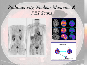 Positron Emission Tomography (PET)