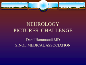 neuro 1 - Sinoe Medical Association