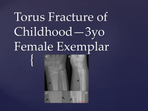 Torus Fracture of Childhood*3yo Female Exemplar