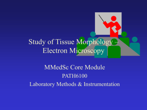 Principles of Transmission Electron Microscopy