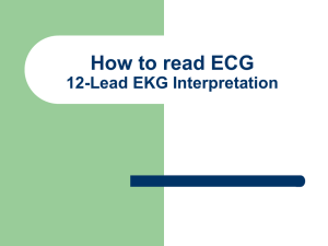 BASIC ECG for students