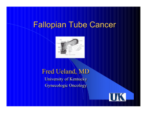 Fallopian Tu be Cancer Fred Ueland , M