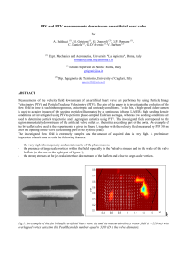 PIV and PTV measurements downstream an artificial heart valve