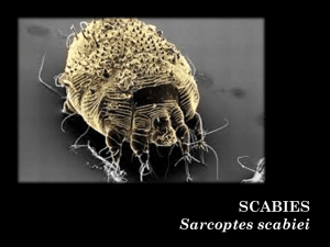 SCABIES Sarcoptes scabiei
