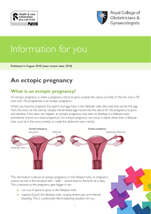 Information for you An ectopic pregnancy