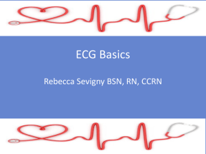 ECG Basics  Rebecca Sevigny BSN, RN, CCRN