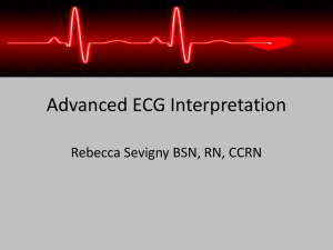 Advanced ECG Interpretation Rebecca Sevigny BSN, RN, CCRN
