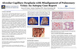Alveolar Capillary Dysplasia with Misalignment of Pulmonary  Kevin O’Connor