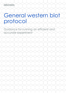 General western blot protocol  Guidance for running an efficient and