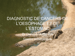 DIAGNOSTIC DE CANCERS DE L’OESOPHAGE ET DE L’ESTOMAC Dr Denis LI KAM WA