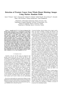 Detection of Prostate Cancer from Whole-Mount Histology Images