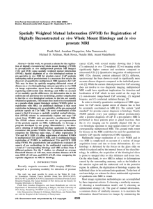Spatially Weighted Mutual Information (SWMI) for Registration of ex vivo prostate MRI