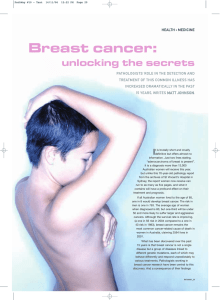 Breast cancer: unlocking the secrets