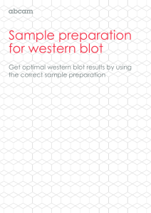 Sample preparation for western blot  Get optimal western blot results by using