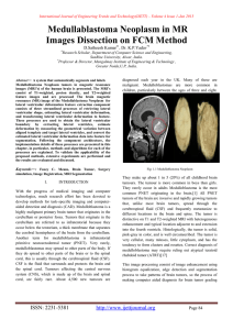 Medullablastoma Neoplasm in MR Images Dissection on FCM Method D.Satheesh Kumar