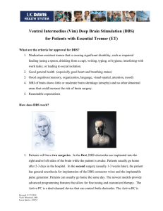 Ventral Intermedius (Vim) Deep Brain Stimulation (DBS)