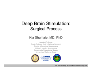 Deep Brain Stimulation: Surgical Process Kia Shahlaie, MD, PhD