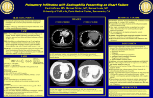 Pulmonary Infiltrates with Eosinophilia Presenting as Heart Failure