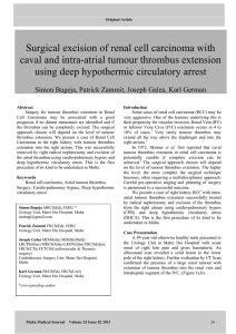 Surgical excision of renal cell carcinoma with