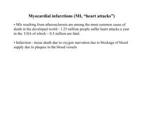Myocardial infarctions (MI, “heart attacks”)