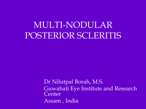 MULTI-NODULAR POSTERIOR SCLERITIS Dr Nilutpal Borah, M.S. Guwahati Eye Institute and Research