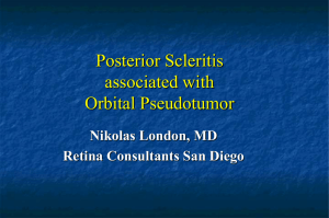 Posterior Scleritis associated with Orbital Pseudotumor Nikolas London, MD