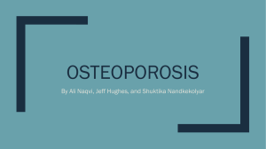 OSTEOPOROSIS By Ali Naqvi, Jeff Hughes, and Shuktika Nandkekolyar