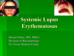 Systemic Lupus Erythematosus Sheetal Desai, MD, MSEd Division of Rheumatology