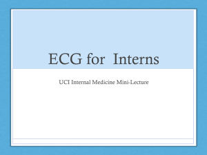 ECG for  Interns UCI Internal Medicine Mini-Lecture