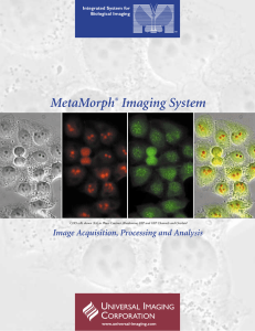 MetaMorph Imaging System U I