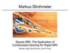 Sparse MRI: The Application of Compressed Sensing for Rapid MRI