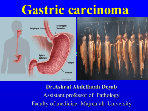 Gastric carcinoma
