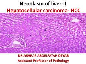 Liver neoplasia