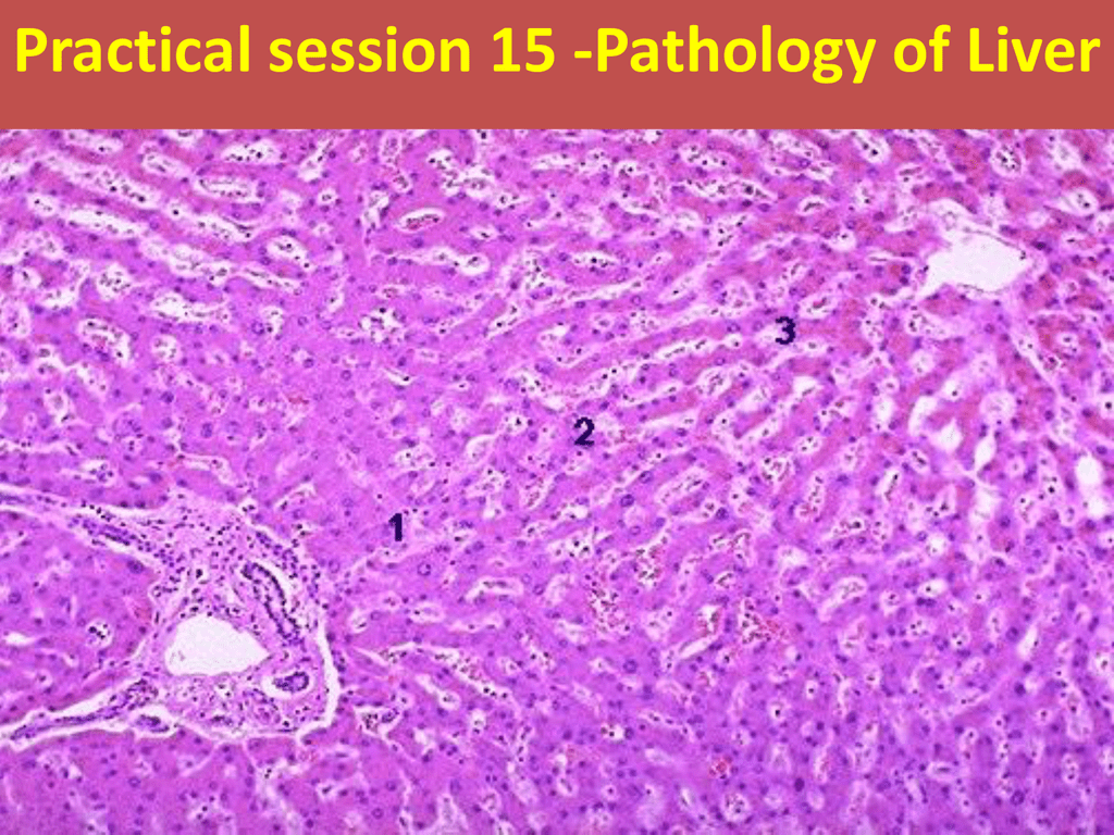 Печень гистология фото