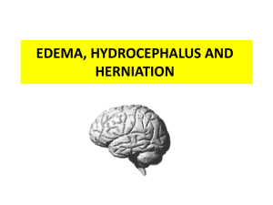 brain edema, hydrocephalus and herniation