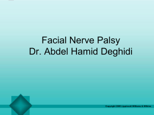 Facial palsy