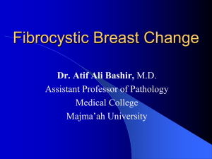 Fibrocystic Breast Change Dr. Atif Ali Bashir, Assistant Professor of Pathology Medical College