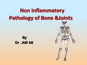 Non Inflammatory Pathology of Bone &amp;Joints By Dr . Atif Ali