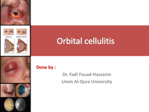 ORBITAL CELLULITIS.pptx