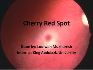 Cherry Red Spot.pptx