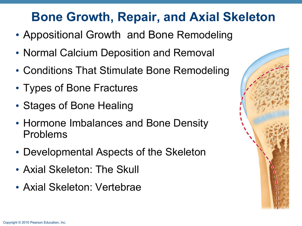 What Is Appositional Growth - slidedocnow