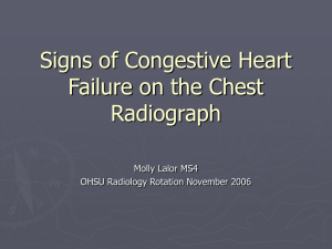 Signs of Congestive Heart Failure on the Chest Radiograph Molly Lalor MS4
