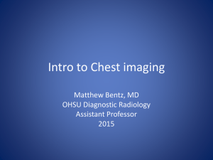 Intro to Chest imaging Matthew Bentz, MD OHSU Diagnostic Radiology Assistant Professor