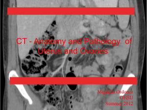 CT - Anatomy and Pathology  of Uterus and Ovaries Migdalia Ordonez OHSU