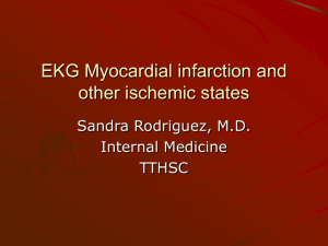 EKG Myocardial infarction and other ischemic states Sandra Rodriguez, M.D. Internal Medicine