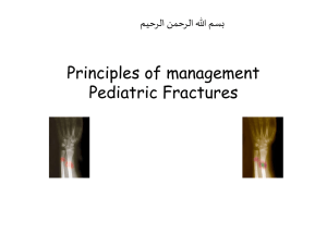 Principles of management Pediatric Fractures ميحرلا نمحرلا الله مسب