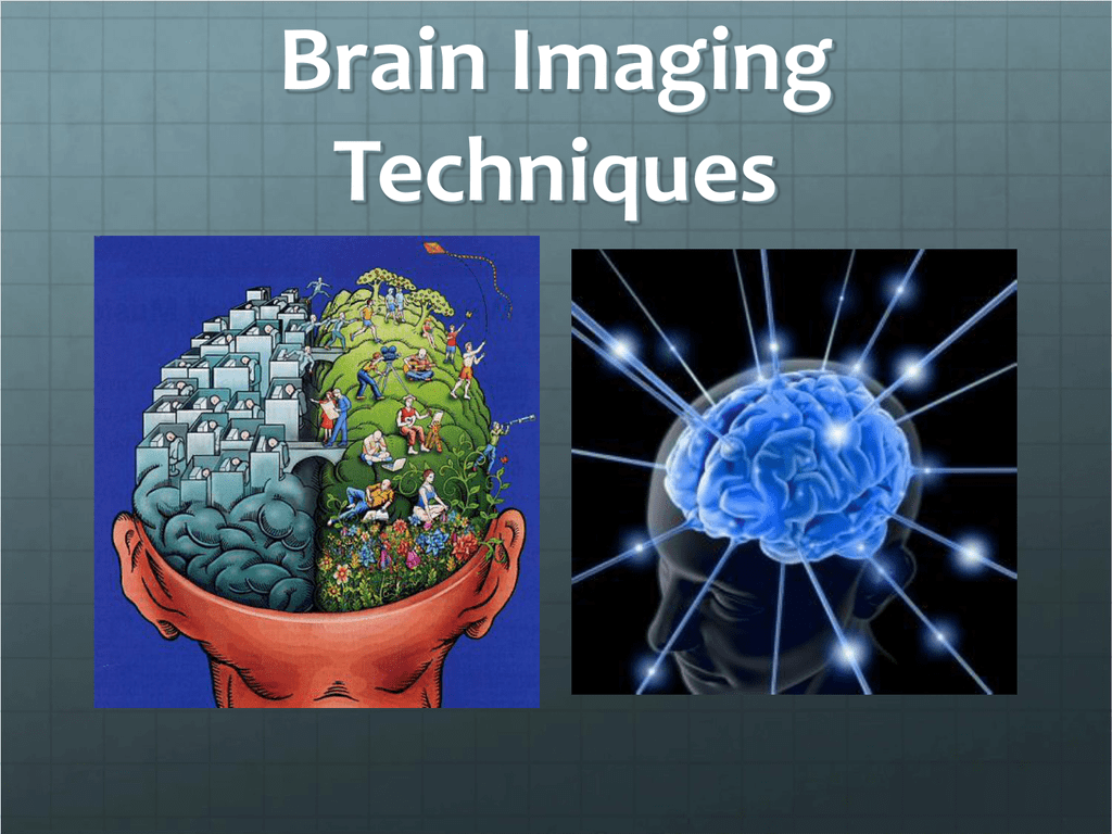 4 Types Of Brain Imaging Techniques - vrogue.co