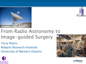 From Radio Astronomy to Image-guided Surgery Terry Peters Robarts Research Institute