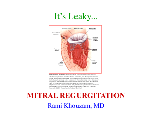 It’s Leaky... MITRAL REGURGITATION Rami Khouzam, MD