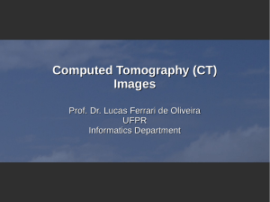 Computed Tomography (CT) Images